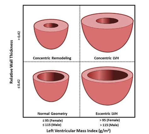 lv wall thickness calculator.